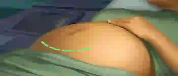 Operate Now Hospital APK Unlimited Money