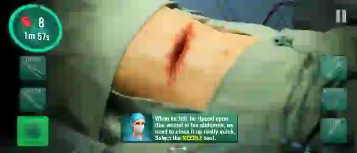 Operate Now Hospital APK Latest Version